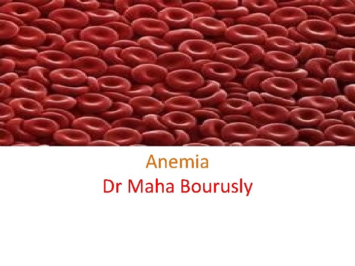 Anemia Dr Maha Bourusly Definitions Anemia New Latin