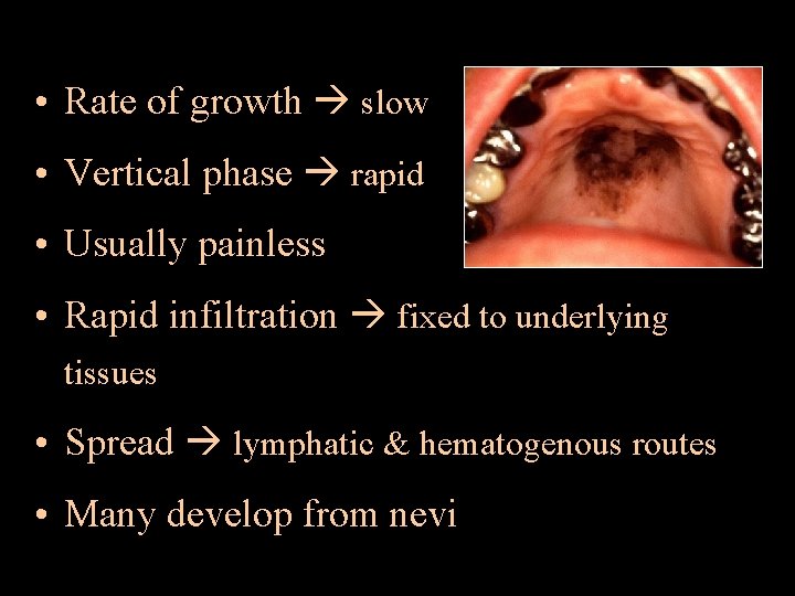  • Rate of growth slow • Vertical phase rapid • Usually painless •
