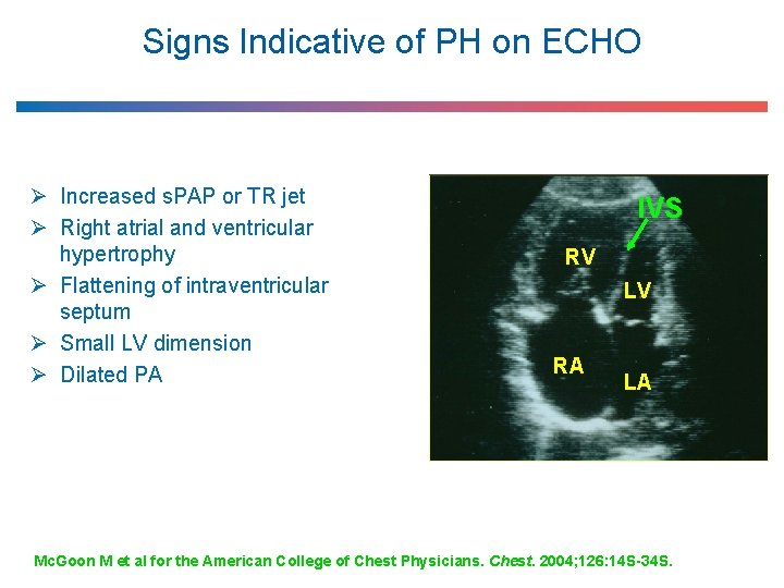 Signs Indicative of PH on ECHO Ø Increased s. PAP or TR jet Ø