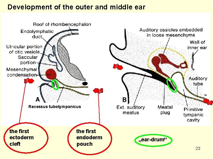 Development of the outer and middle ear Recessus tubotympanicus the first ectoderm cleft the
