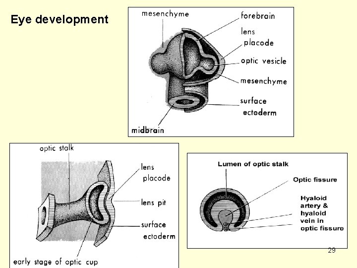 Eye development 29 
