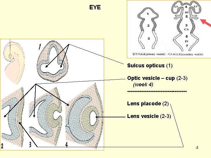 EYE Sulcus opticus (1) Optic vesicle – cup (2 -3) (week 4) -----------------Lens placode