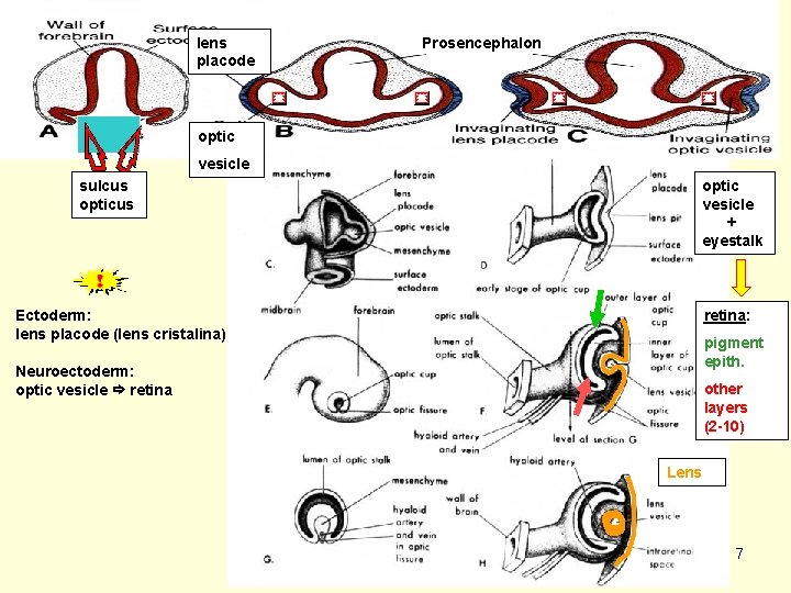 lens placode Prosencephalon optic vesicle sulcus optic vesicle + eyestalk retina: Ectoderm: lens placode