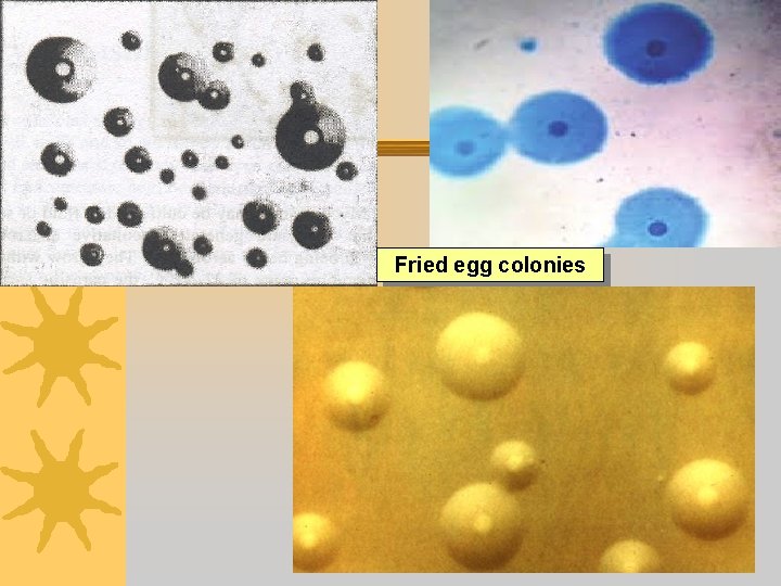 Fried egg colonies Dr Ekta, Microbiology, GMCA 