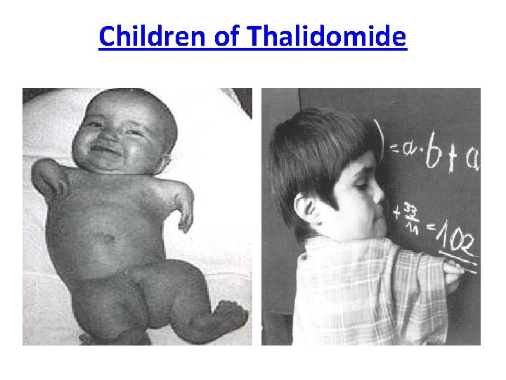 Children of Thalidomide 