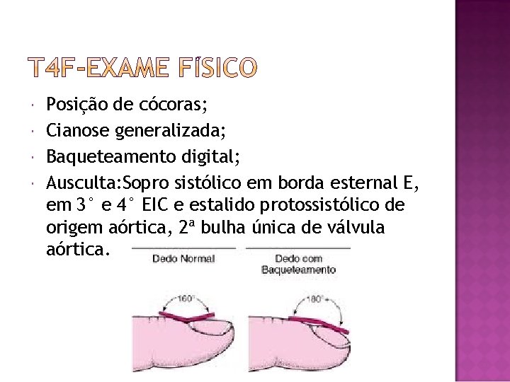  Posição de cócoras; Cianose generalizada; Baqueteamento digital; Ausculta: Sopro sistólico em borda esternal