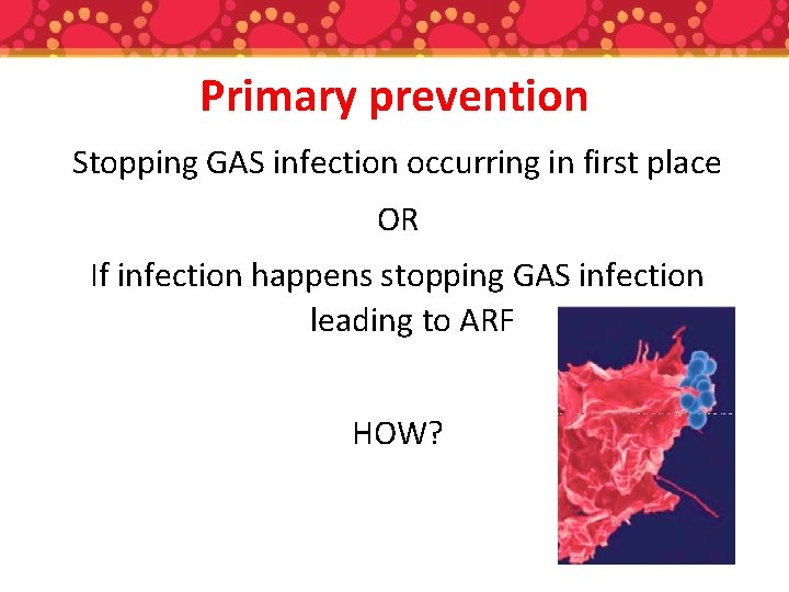 Primary prevention Stopping GAS infection occurring in first place OR If infection happens stopping