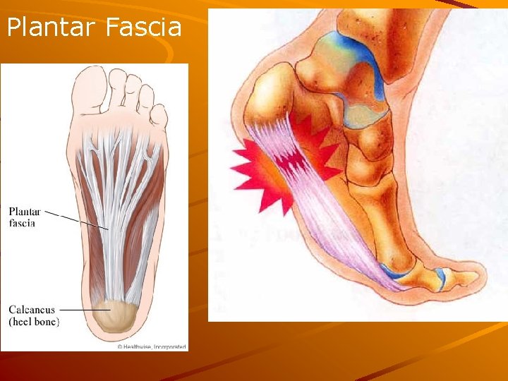 Plantar Fascia 