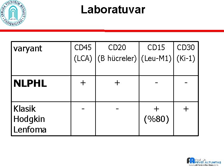 Laboratuvar varyant CD 45 CD 20 CD 15 CD 30 (LCA) (B hücreler) (Leu-M