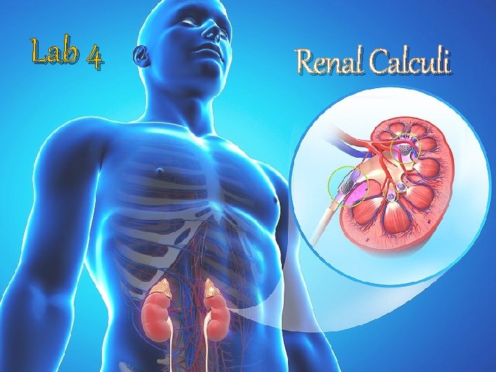 Lab 4 Renal Calculi 