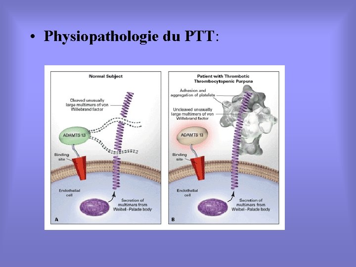  • Physiopathologie du PTT: 