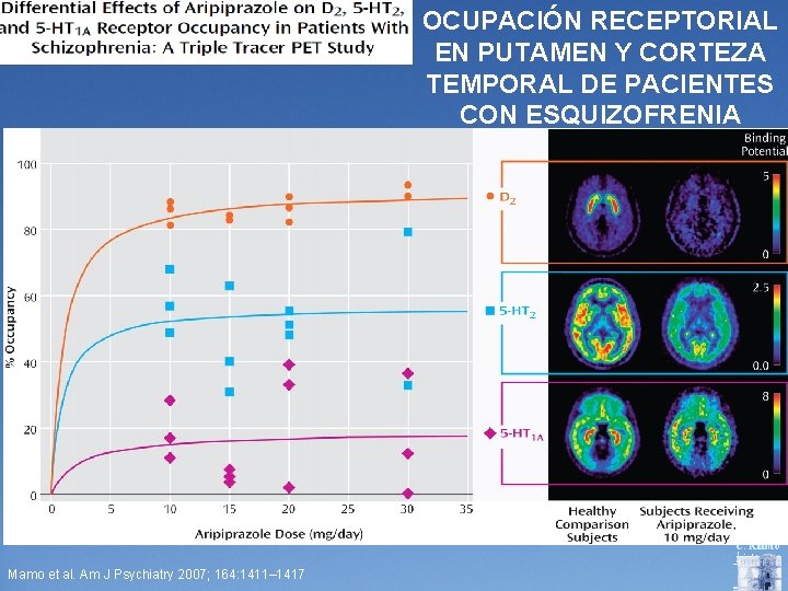 OCUPACIÓN RECEPTORIAL EN PUTAMEN Y CORTEZA TEMPORAL DE PACIENTES CON ESQUIZOFRENIA C. Alamo Mamo