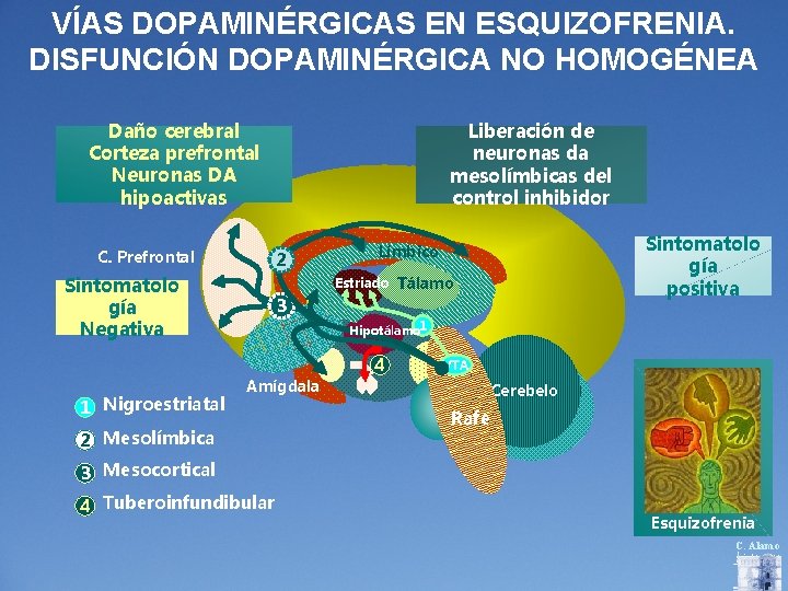 VÍAS DOPAMINÉRGICAS EN ESQUIZOFRENIA. DISFUNCIÓN DOPAMINÉRGICA NO HOMOGÉNEA Daño cerebral Corteza prefrontal Neuronas DA