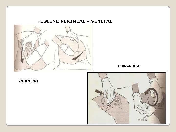 HIGIENE PERINEAL - GENITAL masculina femenina 