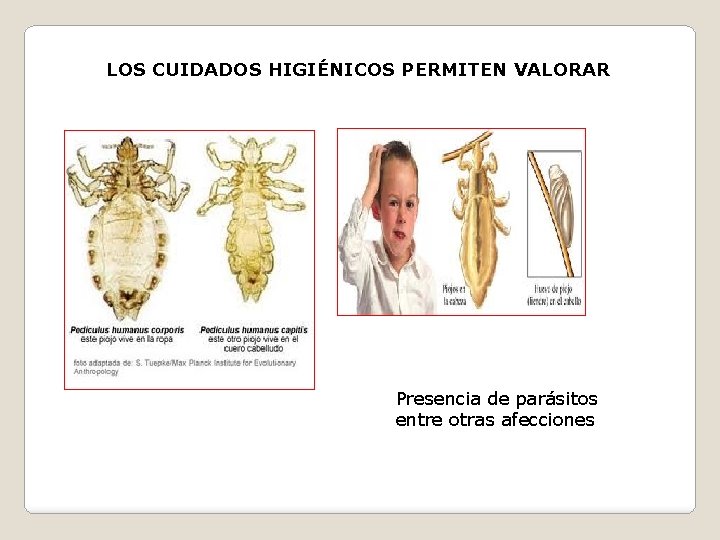 LOS CUIDADOS HIGIÉNICOS PERMITEN VALORAR Presencia de parásitos entre otras afecciones 