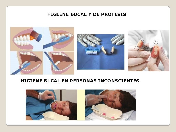 HIGIENE BUCAL Y DE PROTESIS HIGIENE BUCAL EN PERSONAS INCONSCIENTES 