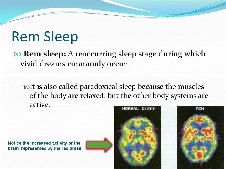 Rem Sleep Rem sleep: A reoccurring sleep stage during which vivid dreams commonly occur.