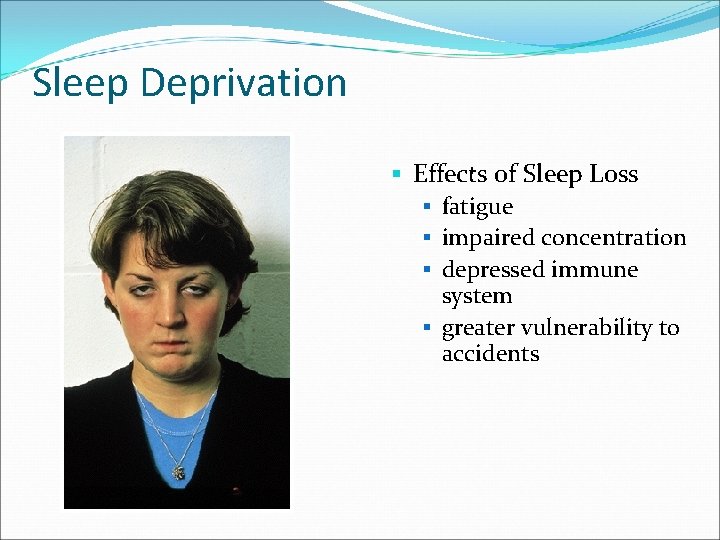 Sleep Deprivation § Effects of Sleep Loss § fatigue § impaired concentration § depressed