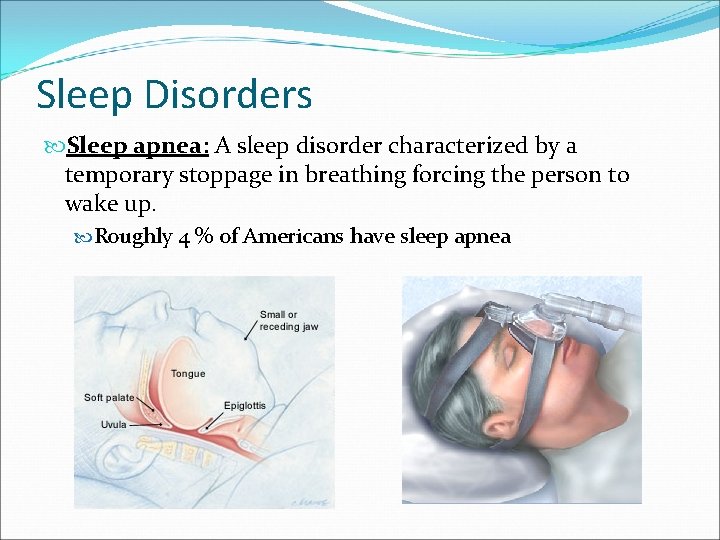 Sleep Disorders Sleep apnea: A sleep disorder characterized by a temporary stoppage in breathing