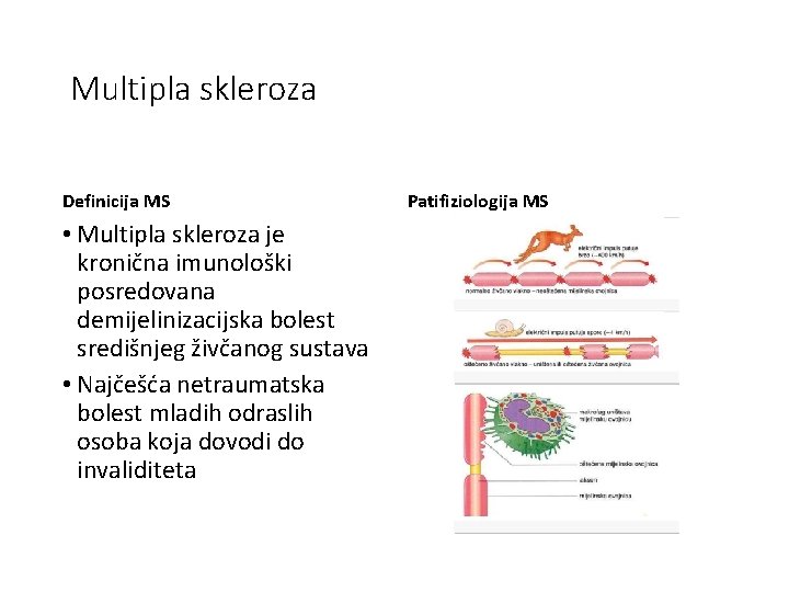 Multipla skleroza Definicija MS • Multipla skleroza je kronična imunološki posredovana demijelinizacijska bolest središnjeg