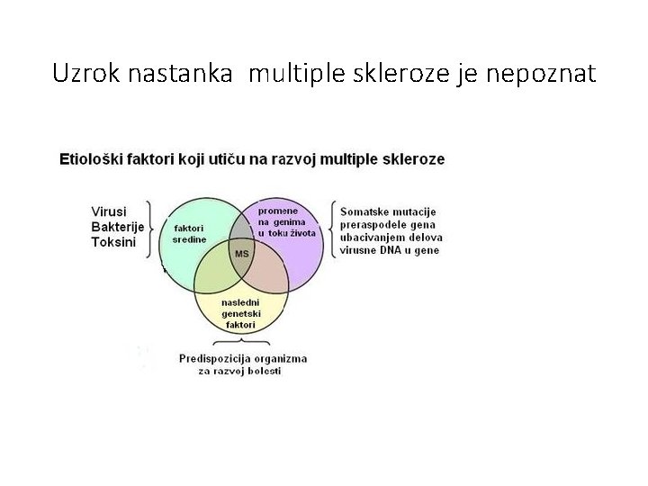 Uzrok nastanka multiple skleroze je nepoznat 