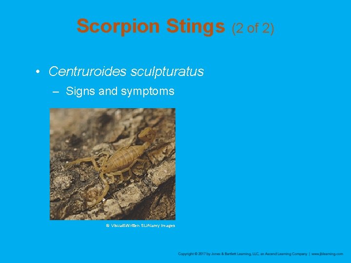 Scorpion Stings (2 of 2) • Centruroides sculpturatus – Signs and symptoms © Visual&Written