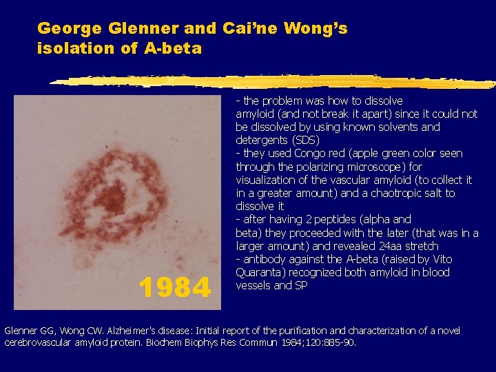 George Glenner and Cai’ne Wong’s isolation of A-beta 1984 - the problem was how