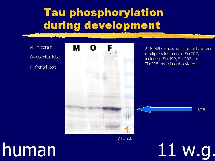 Tau phosphorylation during development M=midbrain AT 8 MAb reacts with tau only when multiple
