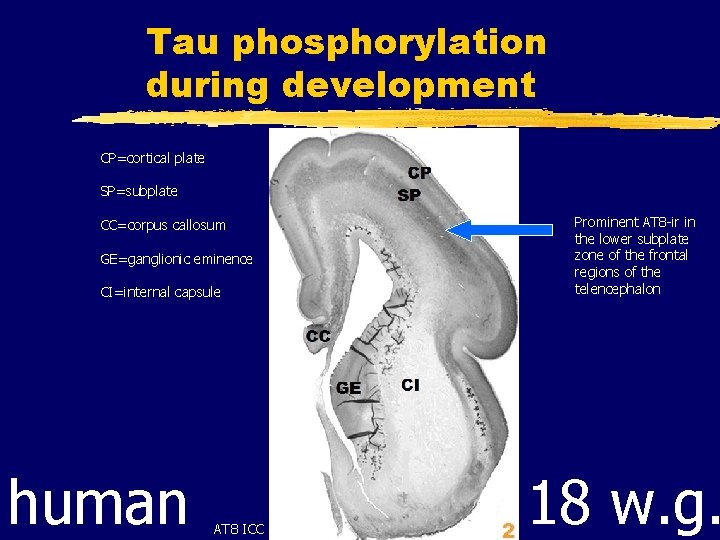 Tau phosphorylation during development CP=cortical plate SP=subplate Prominent AT 8 -ir in the lower