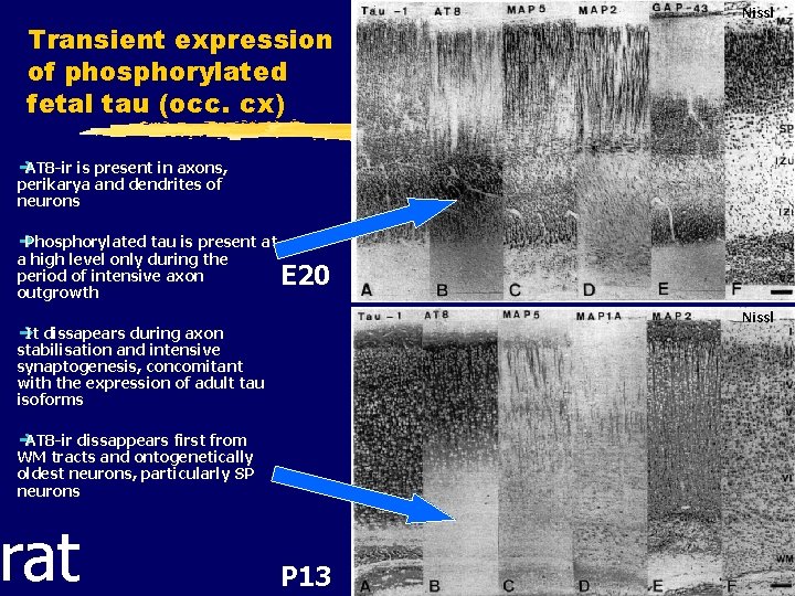 Transient expression of phosphorylated fetal tau (occ. cx) Nissl è AT 8 -ir is