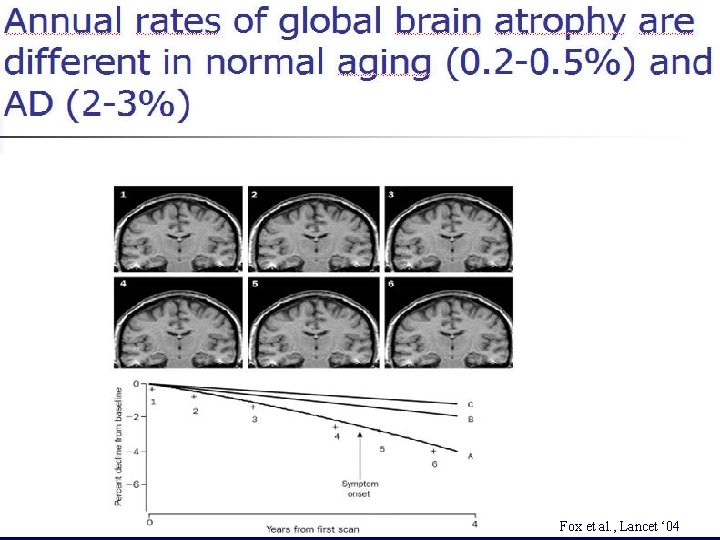 Fox et al. Lancet ‘ 04 Fox et al. , Lancet ‘ 04 