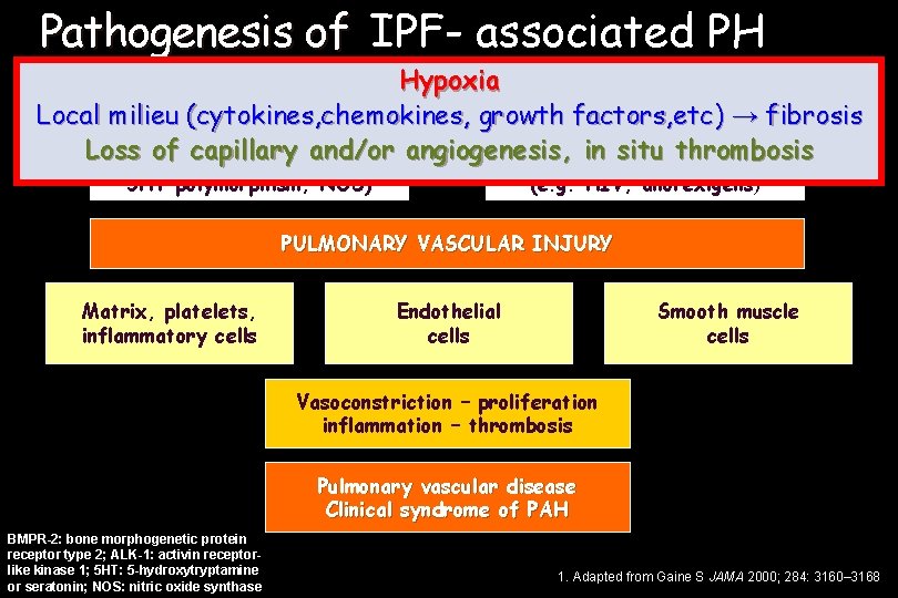 Pathogenesis of PAH IPF- associated PH Hypoxia Local milieu (cytokines, chemokines, growth factors, etc)