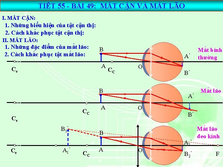 TIẾT 55 - BÀI 49: MẮT CẬN VÀ MẮT LÃO I. MẮT CẬN: 1.