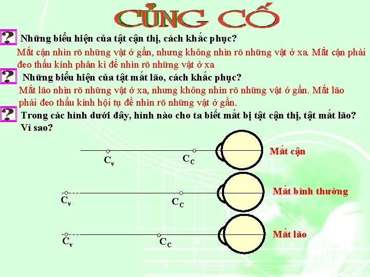 Những biểu hiện của tật cận thị, cách khắc phục? Mắt cận nhìn rõ