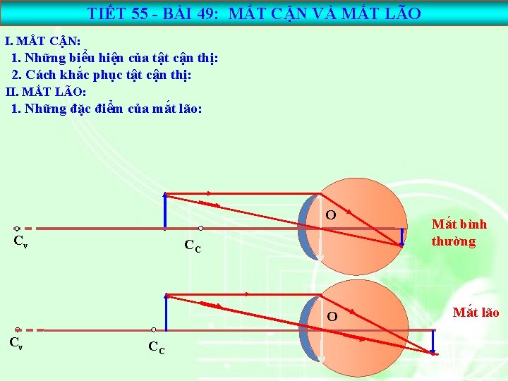 TIẾT 55 - BÀI 49: MẮT CẬN VÀ MẮT LÃO I. MẮT CẬN: 1.