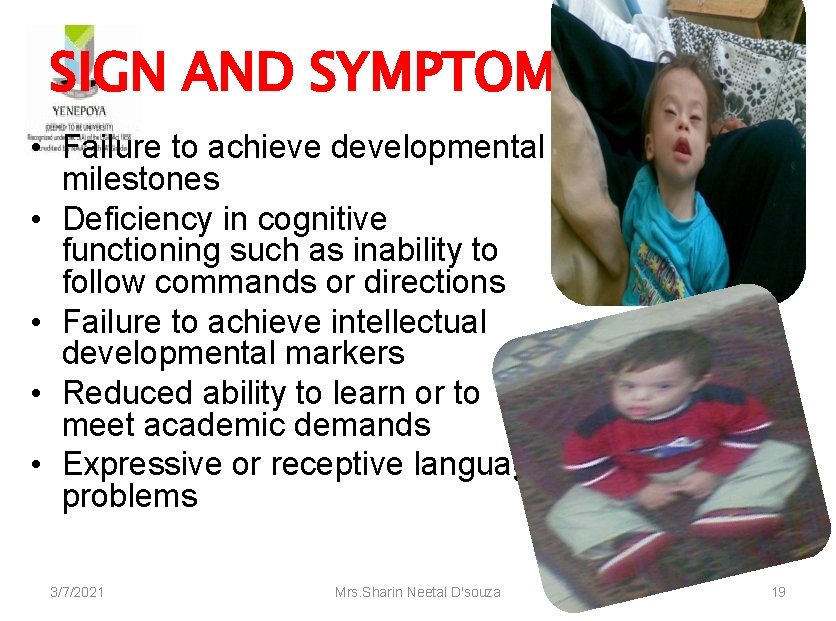 SIGN AND SYMPTOMS • Failure to achieve developmental milestones • Deficiency in cognitive functioning