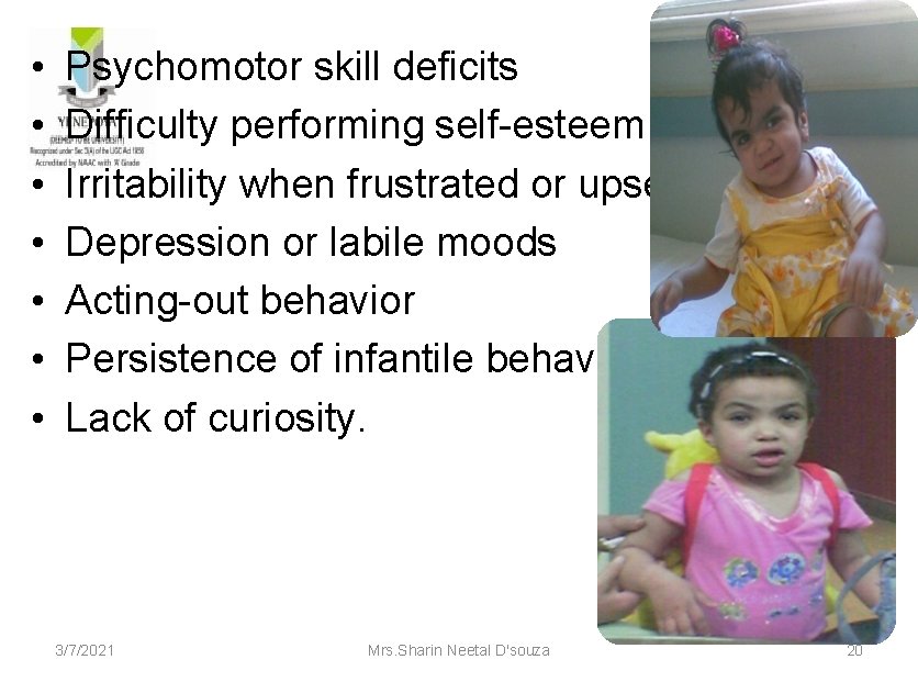  • • Psychomotor skill deficits Difficulty performing self-esteem Irritability when frustrated or upset
