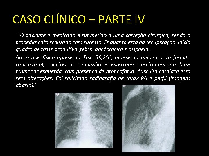 CASO CLÍNICO – PARTE IV “O paciente é medicado e submetido a uma correção