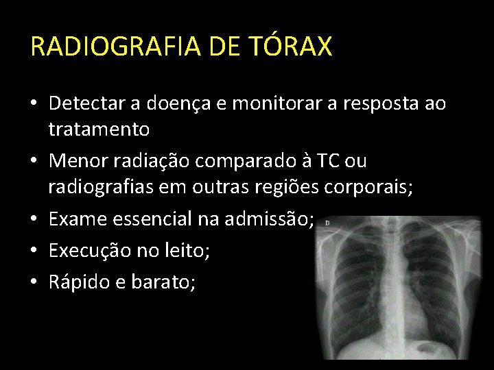 RADIOGRAFIA DE TÓRAX • Detectar a doença e monitorar a resposta ao tratamento •