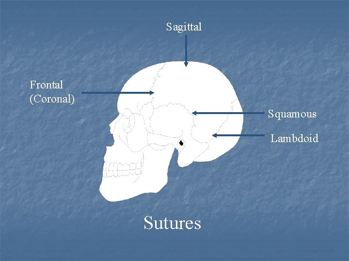 Sagittal Frontal (Coronal) Squamous Lambdoid Sutures 