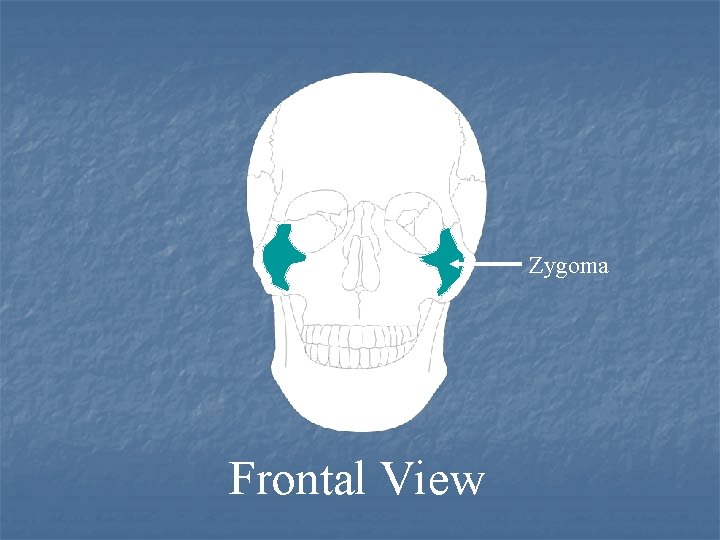 Zygoma Frontal View 