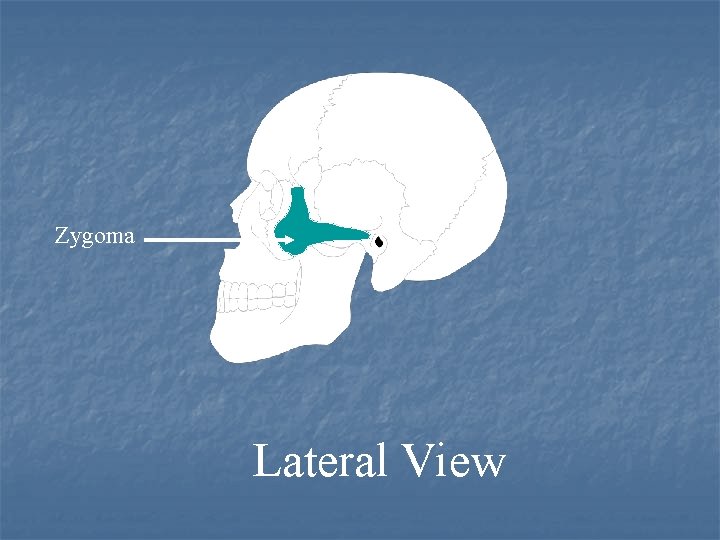 Zygoma Lateral View 