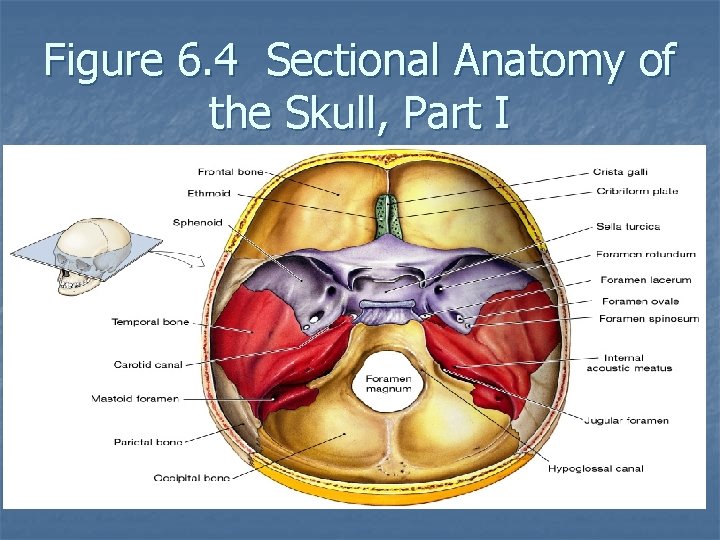 Figure 6. 4 Sectional Anatomy of the Skull, Part I 