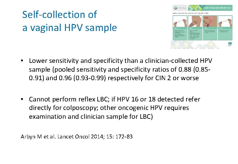 Self-collection of a vaginal HPV sample • Lower sensitivity and specificity than a clinician-collected