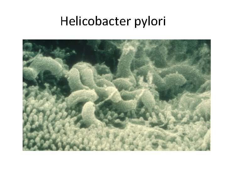 Helicobacter pylori Helicobacter pylori