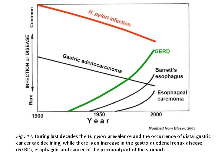 Fig. 12. During last decades the H. pylori prevalence and the occurrence of distal Fig. 12. During last decades the H. pylori prevalence and the occurrence of distal