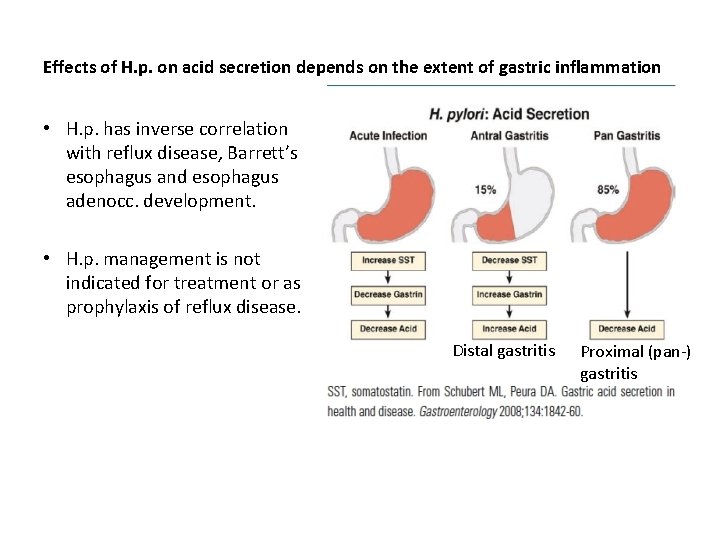 Effects of H. p. on acid secretion depends on the extent of gastric inflammation Effects of H. p. on acid secretion depends on the extent of gastric inflammation