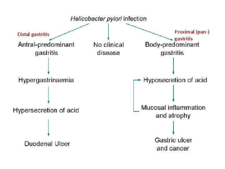 Distal gastritis Proximal (pan-) gastritis Distal gastritis Proximal (pan-) gastritis