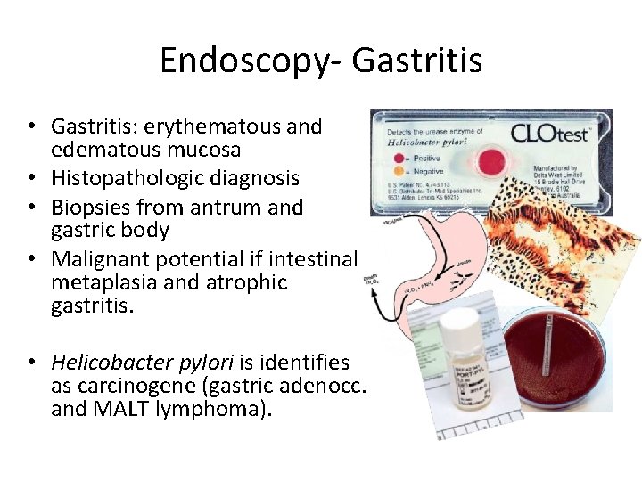 Endoscopy- Gastritis • Gastritis: erythematous and edematous mucosa • Histopathologic diagnosis • Biopsies from Endoscopy- Gastritis • Gastritis: erythematous and edematous mucosa • Histopathologic diagnosis • Biopsies from
