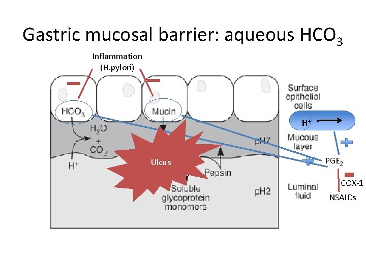 Gastric mucosal barrier: aqueous HCO 3 Inflammation (H. pylori) H+ Ulcus PGE 2 COX-1 Gastric mucosal barrier: aqueous HCO 3 Inflammation (H. pylori) H+ Ulcus PGE 2 COX-1
